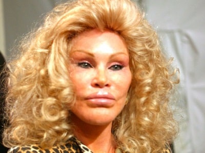A picture of Jocelyn Wildenstein with her big lips.